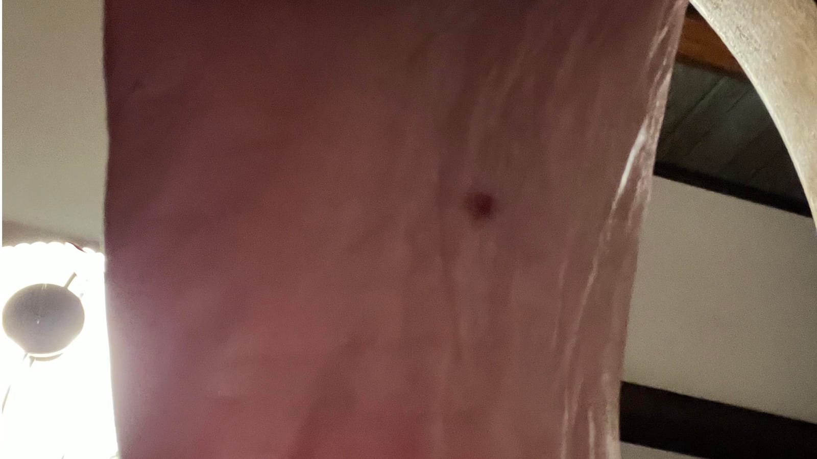 A small circle on the bottom of foot kinda looks like a tick bite but not sure